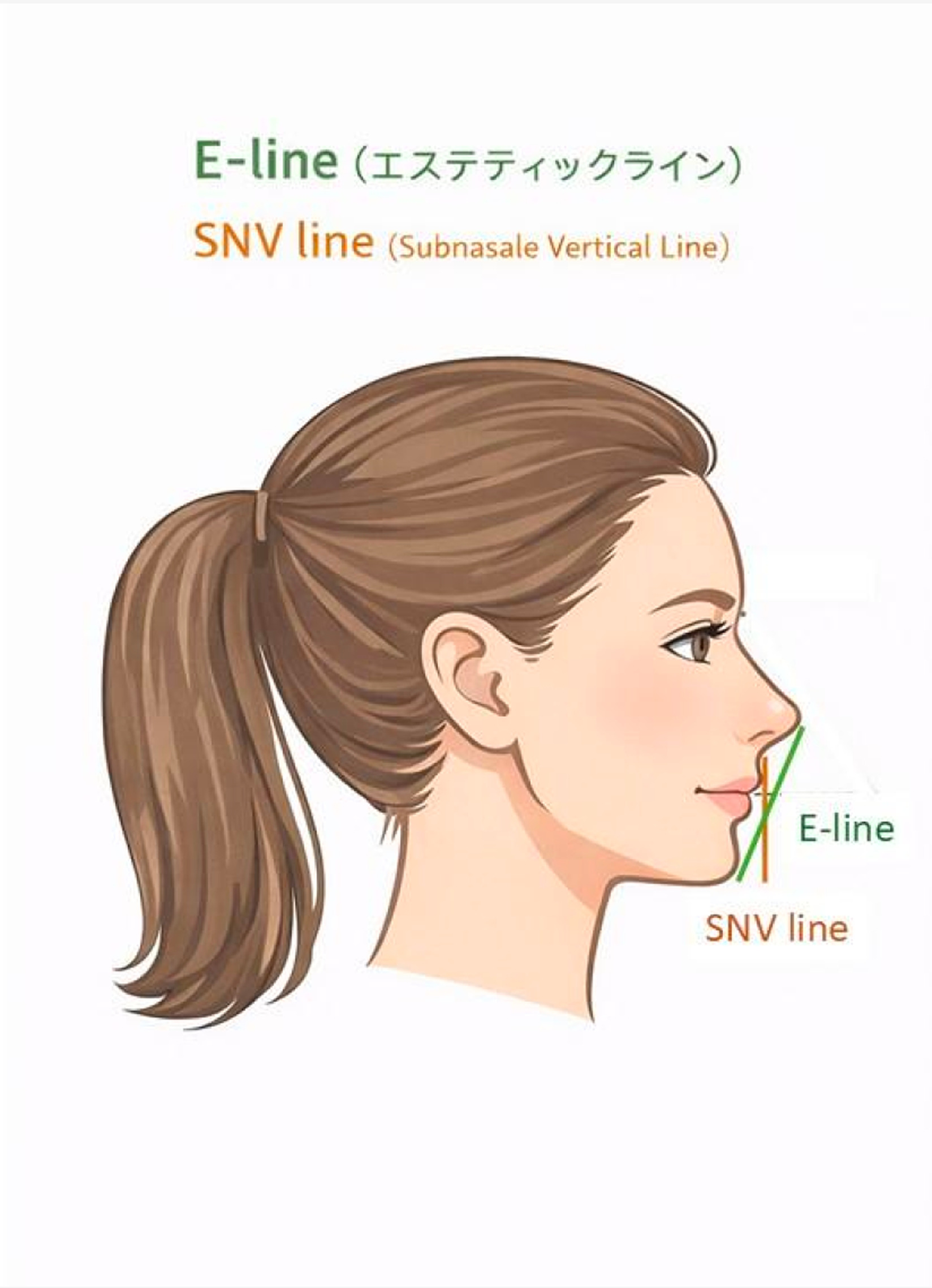 エステティックライン