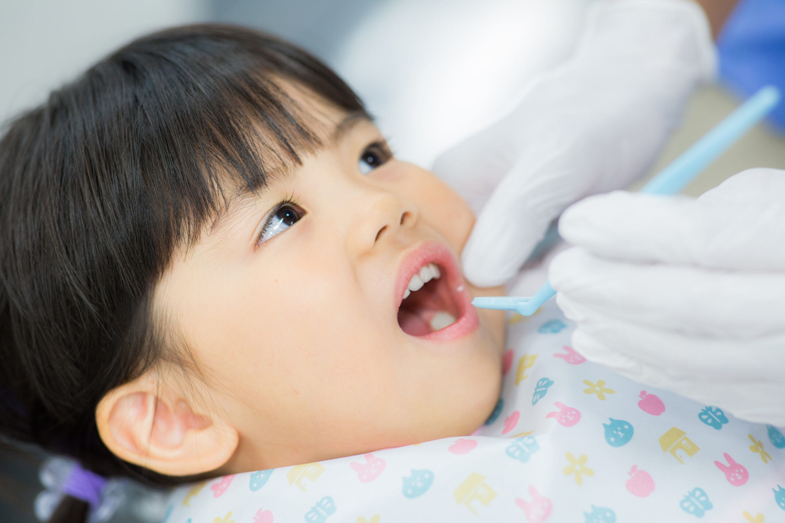 小児矯正は治療のタイミングが大事